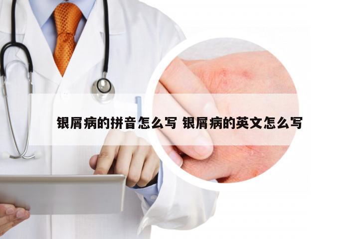 银屑病的拼音怎么写 银屑病的英文怎么写