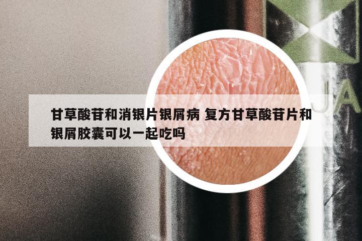 甘草酸苷和消银片银屑病 复方甘草酸苷片和银屑胶囊可以一起吃吗