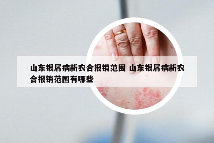 山东银屑病新农合报销范围 山东银屑病新农合报销范围有哪些