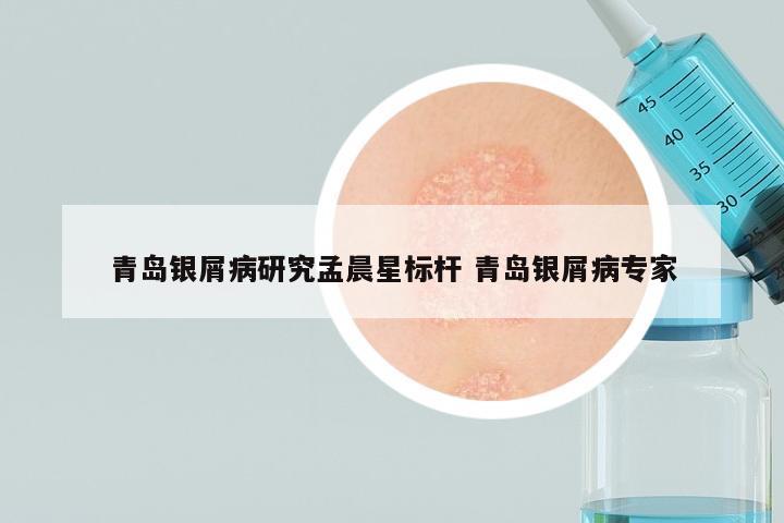 青岛银屑病研究孟晨星标杆 青岛银屑病专家