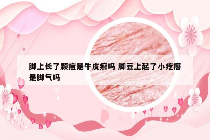 脚上长了颗痘是牛皮癣吗 脚豆上起了小疙瘩是脚气吗