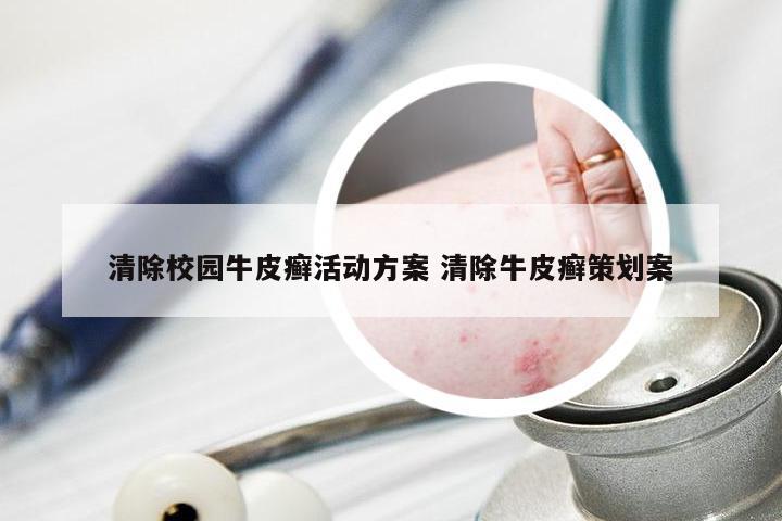 清除校园牛皮癣活动方案 清除牛皮癣策划案