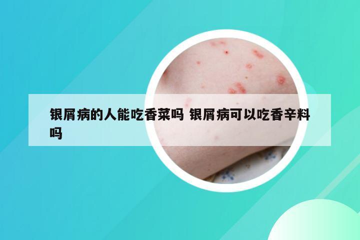 银屑病的人能吃香菜吗 银屑病可以吃香辛料吗