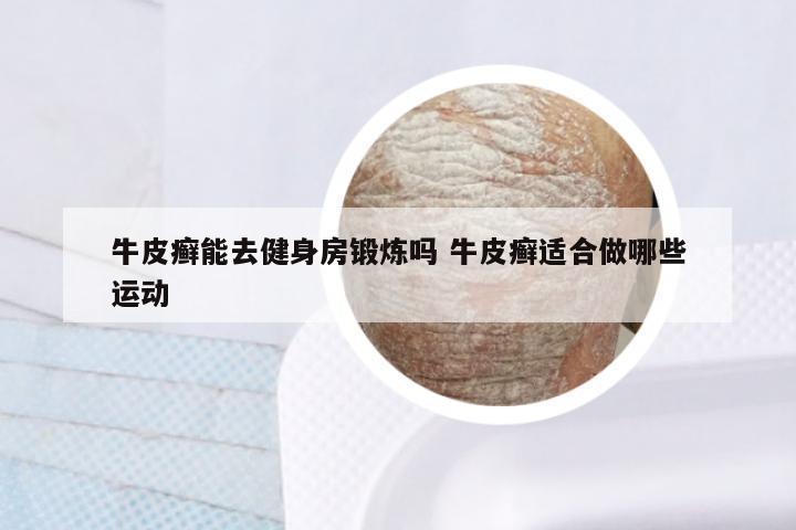 牛皮癣能去健身房锻炼吗 牛皮癣适合做哪些运动