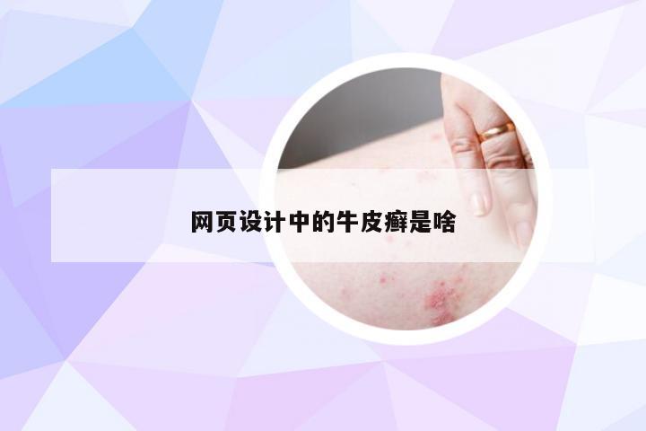 网页设计中的牛皮癣是啥
