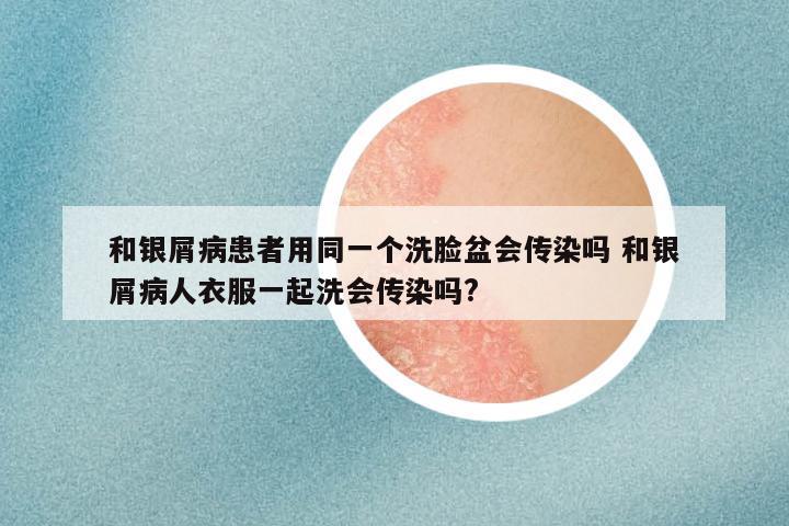 和银屑病患者用同一个洗脸盆会传染吗 和银屑病人衣服一起洗会传染吗?