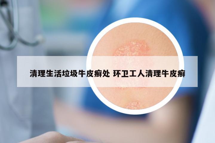 清理生活垃圾牛皮癣处 环卫工人清理牛皮癣