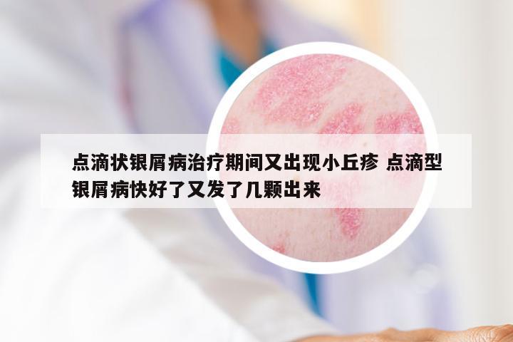 点滴状银屑病治疗期间又出现小丘疹 点滴型银屑病快好了又发了几颗出来