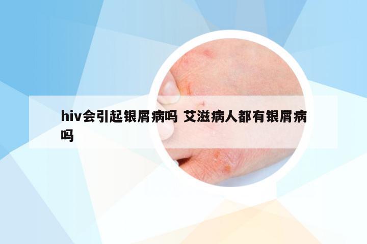 hiv会引起银屑病吗 艾滋病人都有银屑病吗