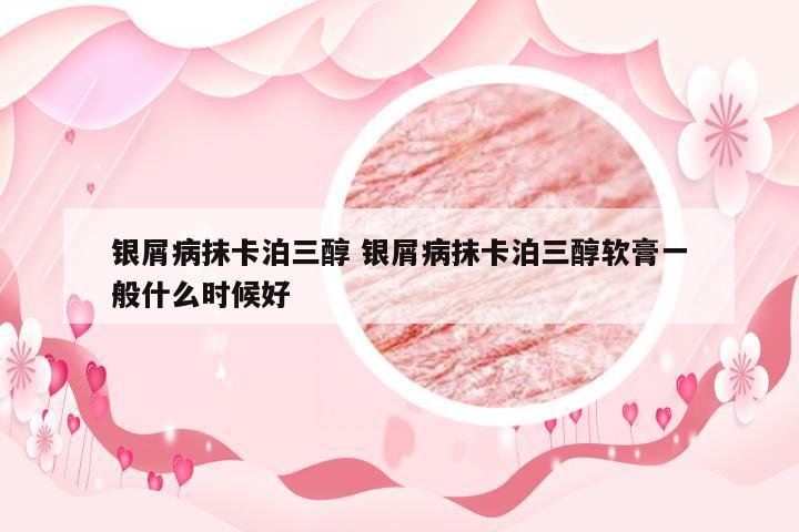 银屑病抹卡泊三醇 银屑病抹卡泊三醇软膏一般什么时候好