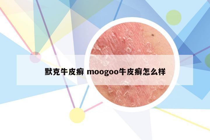 默克牛皮癣 moogoo牛皮癣怎么样