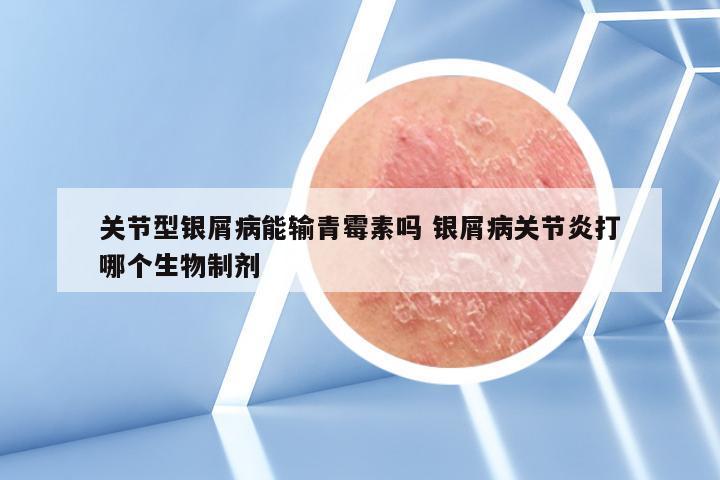 关节型银屑病能输青霉素吗 银屑病关节炎打哪个生物制剂