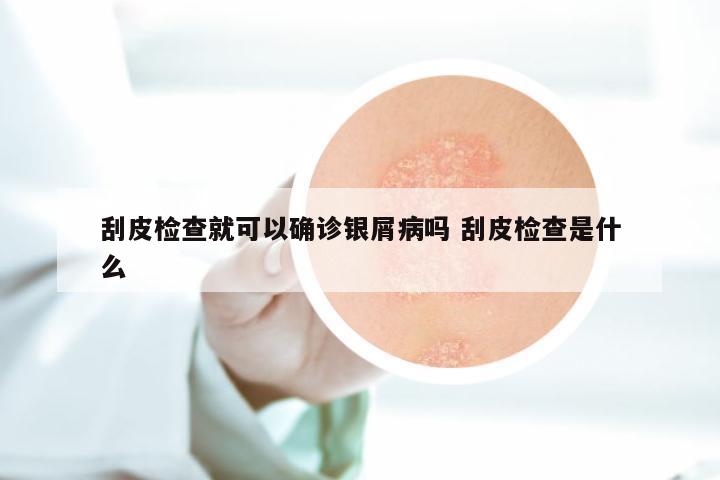 刮皮检查就可以确诊银屑病吗 刮皮检查是什么