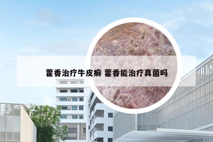 藿香治疗牛皮癣 藿香能治疗真菌吗
