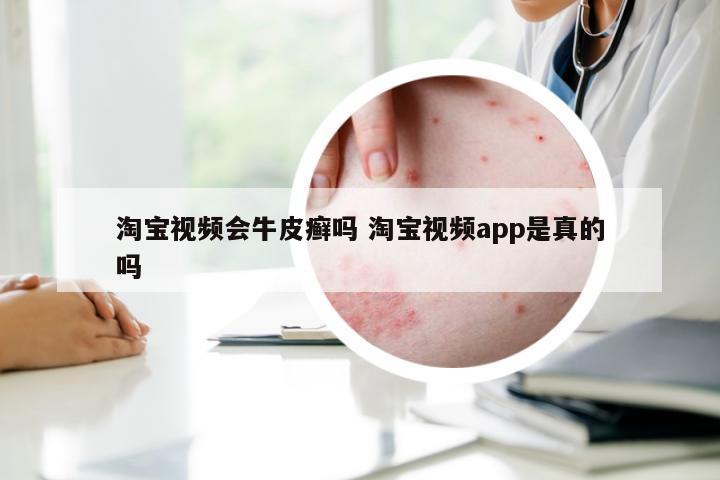 淘宝视频会牛皮癣吗 淘宝视频app是真的吗