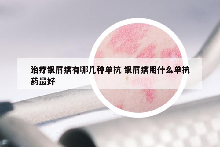 治疗银屑病有哪几种单抗 银屑病用什么单抗药最好