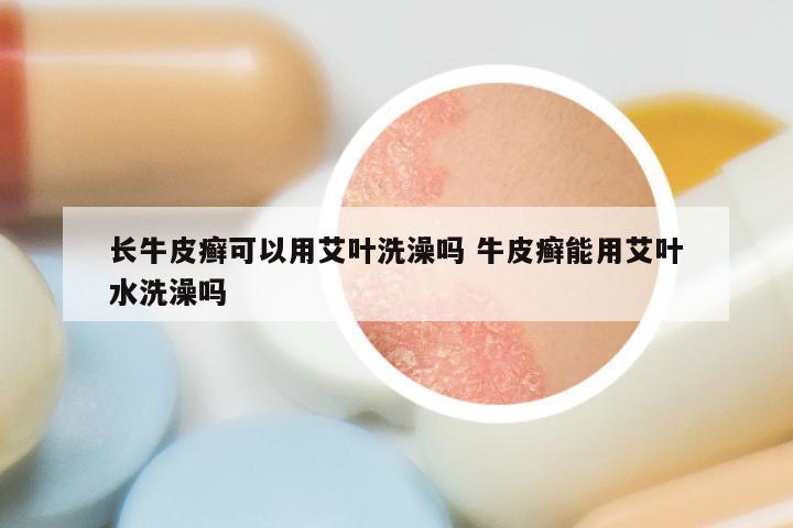 长牛皮癣可以用艾叶洗澡吗 牛皮癣能用艾叶水洗澡吗