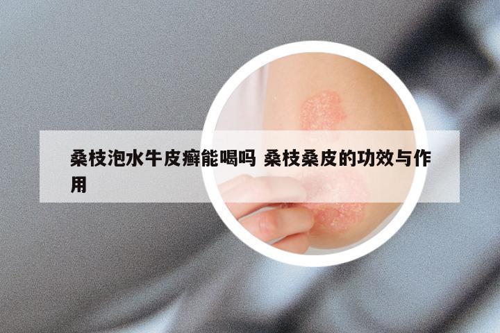 桑枝泡水牛皮癣能喝吗 桑枝桑皮的功效与作用