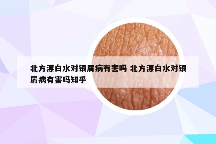 北方漂白水对银屑病有害吗 北方漂白水对银屑病有害吗知乎