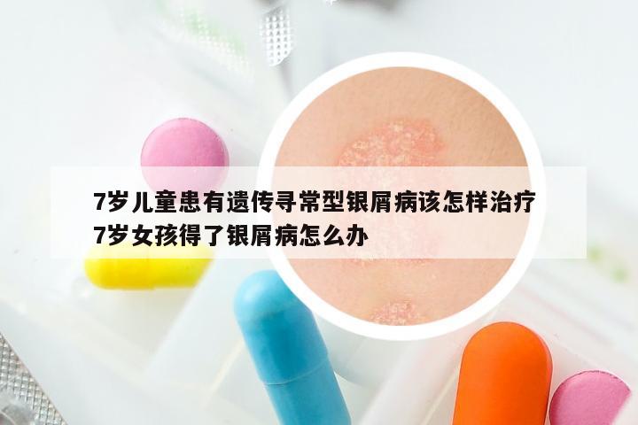 7岁儿童患有遗传寻常型银屑病该怎样治疗 7岁女孩得了银屑病怎么办