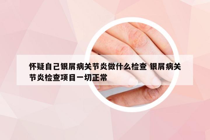 怀疑自己银屑病关节炎做什么检查 银屑病关节炎检查项目一切正常