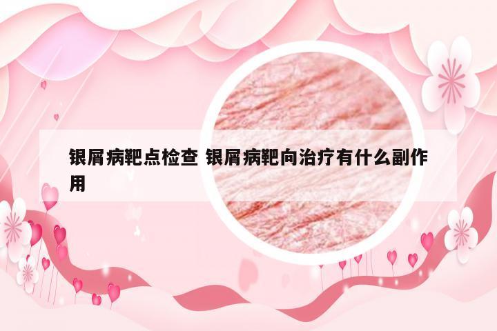 银屑病靶点检查 银屑病靶向治疗有什么副作用