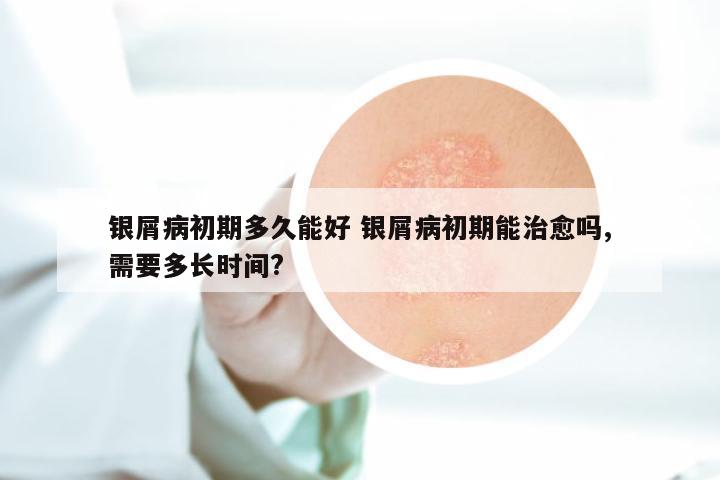 银屑病初期多久能好 银屑病初期能治愈吗,需要多长时间?