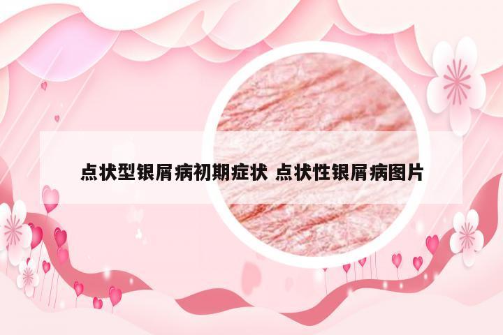 点状型银屑病初期症状 点状性银屑病图片