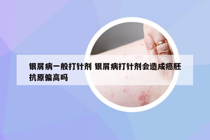 银屑病一般打针剂 银屑病打针剂会造成癌胚抗原偏高吗