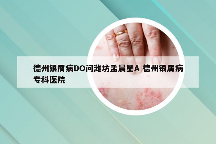 德州银屑病DO问潍坊孟晨星A 德州银屑病专科医院