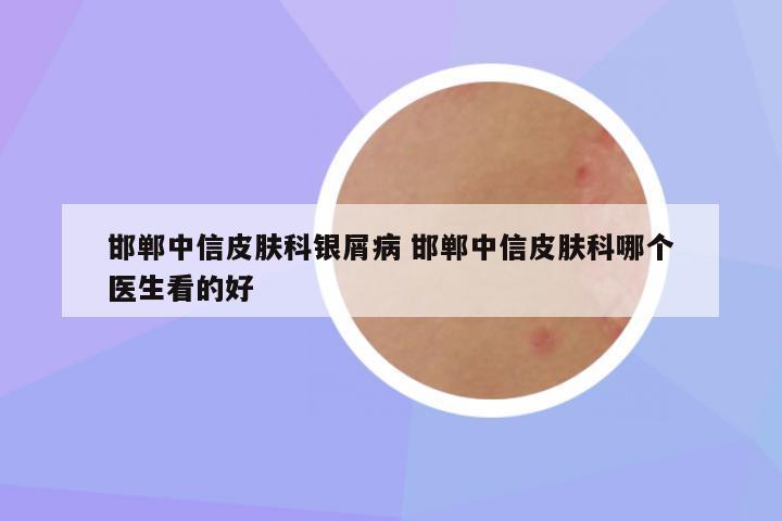 邯郸中信皮肤科银屑病 邯郸中信皮肤科哪个医生看的好