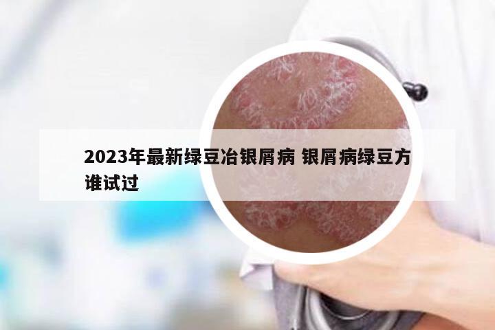 2023年最新绿豆冶银屑病 银屑病绿豆方谁试过