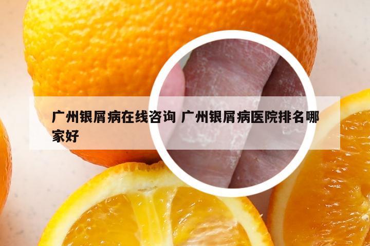 广州银屑病在线咨询 广州银屑病医院排名哪家好