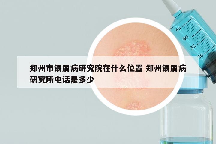 郑州市银屑病研究院在什么位置 郑州银屑病研究所电话是多少