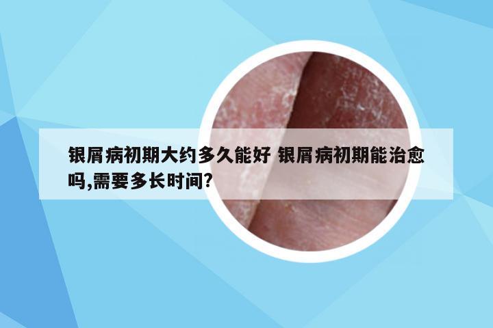 银屑病初期大约多久能好 银屑病初期能治愈吗,需要多长时间?