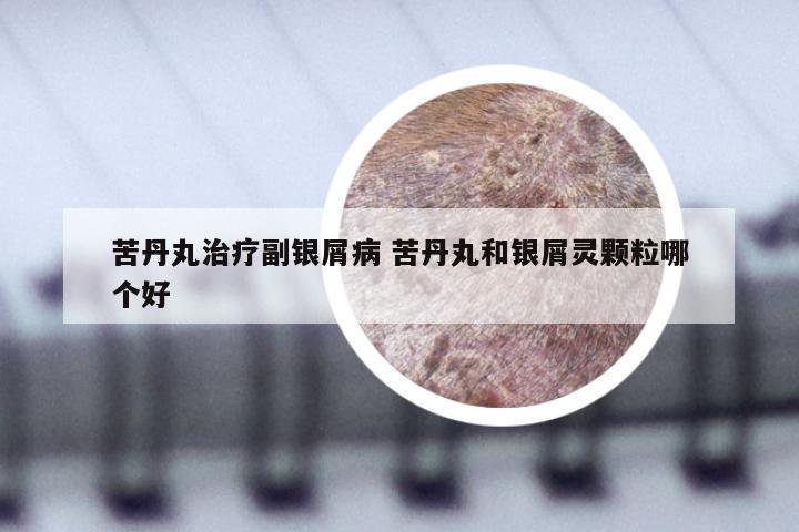苦丹丸治疗副银屑病 苦丹丸和银屑灵颗粒哪个好