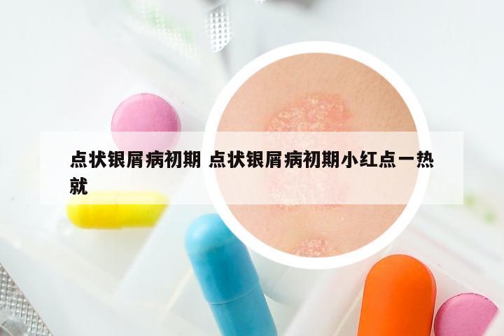 点状银屑病初期 点状银屑病初期小红点一热就