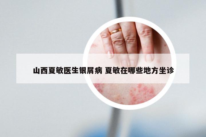 山西夏敏医生银屑病 夏敏在哪些地方坐诊
