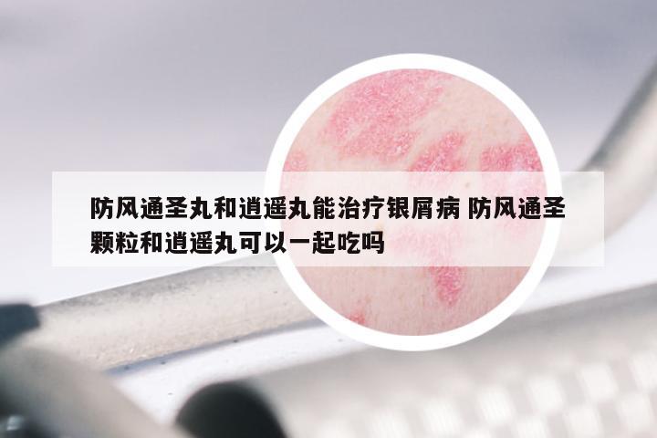 防风通圣丸和逍遥丸能治疗银屑病 防风通圣颗粒和逍遥丸可以一起吃吗