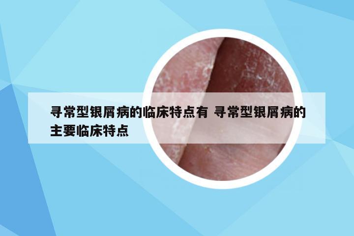 寻常型银屑病的临床特点有 寻常型银屑病的主要临床特点