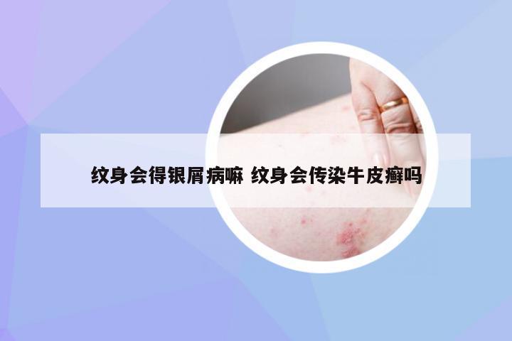 纹身会得银屑病嘛 纹身会传染牛皮癣吗