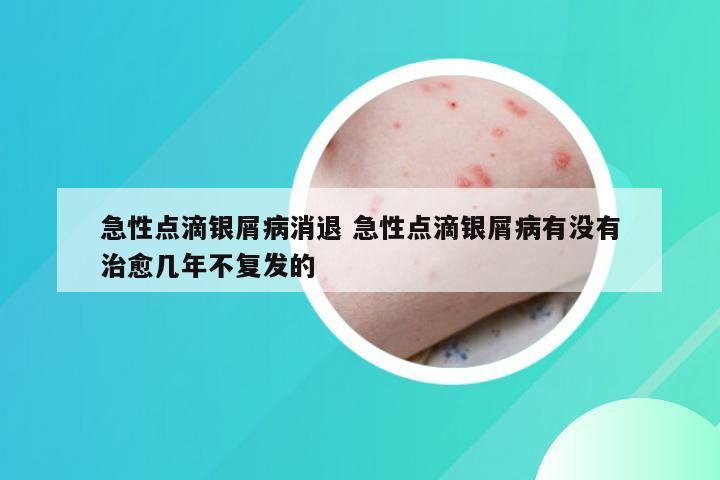 急性点滴银屑病消退 急性点滴银屑病有没有治愈几年不复发的