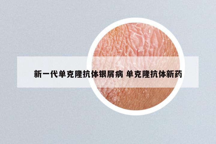 新一代单克隆抗体银屑病 单克隆抗体新药