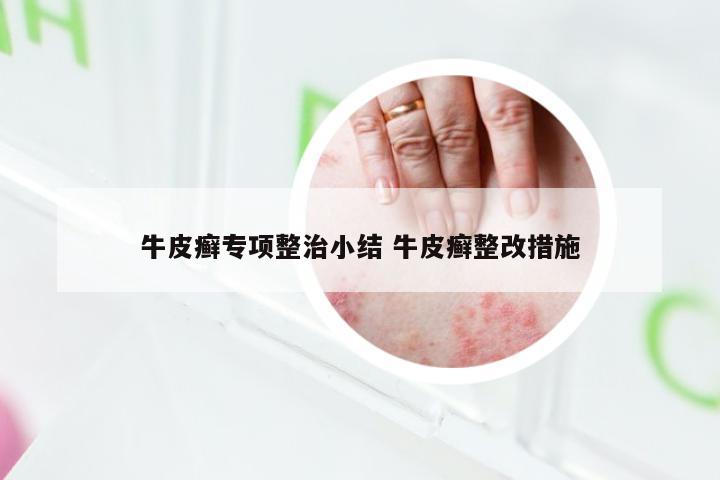 牛皮癣专项整治小结 牛皮癣整改措施
