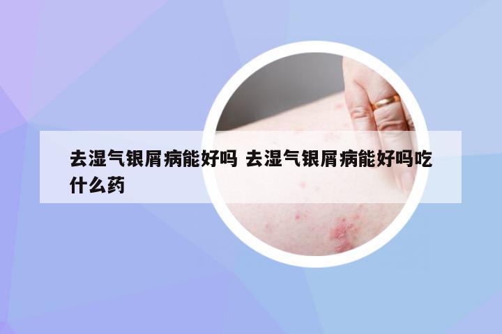 去湿气银屑病能好吗 去湿气银屑病能好吗吃什么药