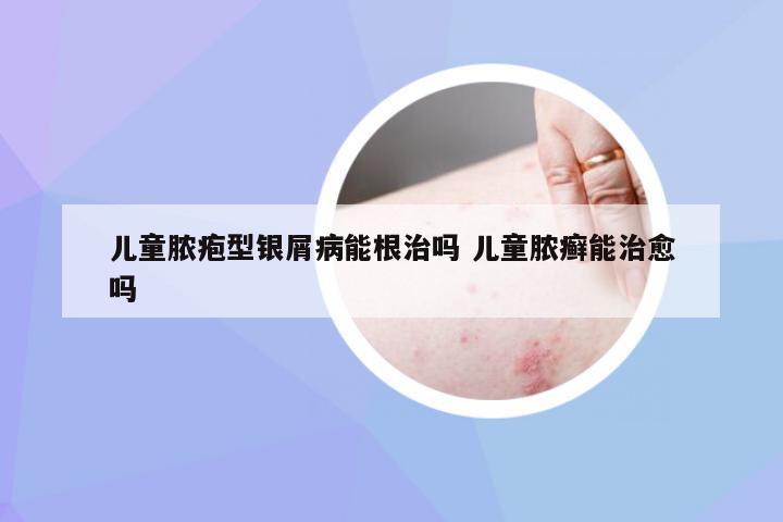 儿童脓疱型银屑病能根治吗 儿童脓癣能治愈吗