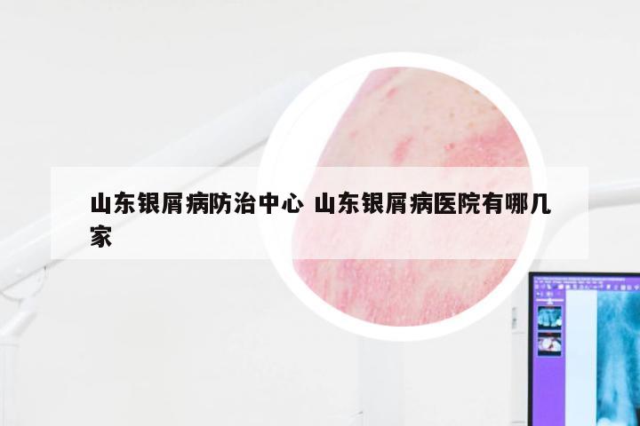 山东银屑病防治中心 山东银屑病医院有哪几家