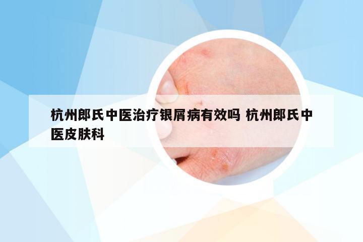 杭州郎氏中医治疗银屑病有效吗 杭州郎氏中医皮肤科