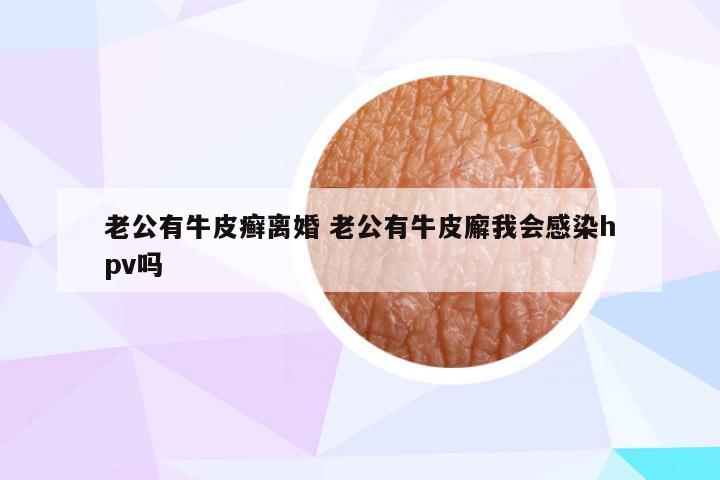 老公有牛皮癣离婚 老公有牛皮廨我会感染hpv吗