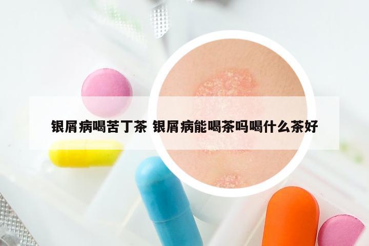 银屑病喝苦丁茶 银屑病能喝茶吗喝什么茶好
